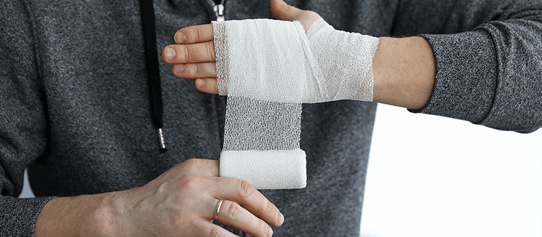 Electrical Burn Injury